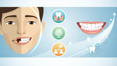 What Are Cosmetic Dental Implants and How Do They Improve Your Smile?