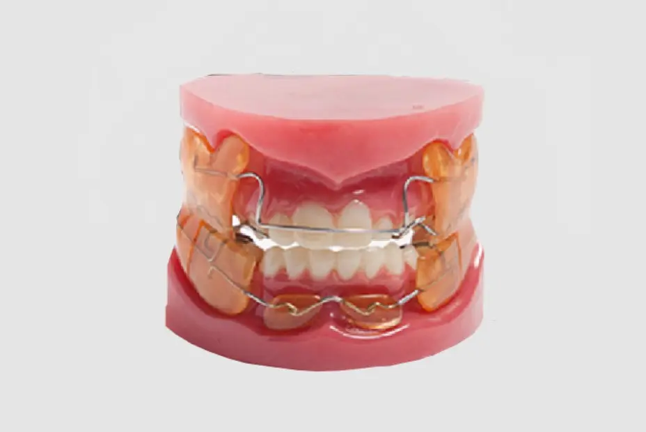 Othopedic Functional Appliance(Funstion Regulator) (3)