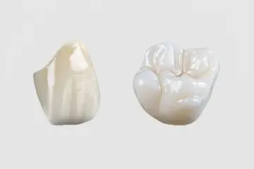 Full Zirconia Crowns & Bridges - High-Strength