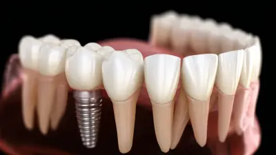 Transforming Smiles: The Future of Digital Dental Implants Explained