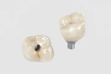 Implant Crown&Bridge