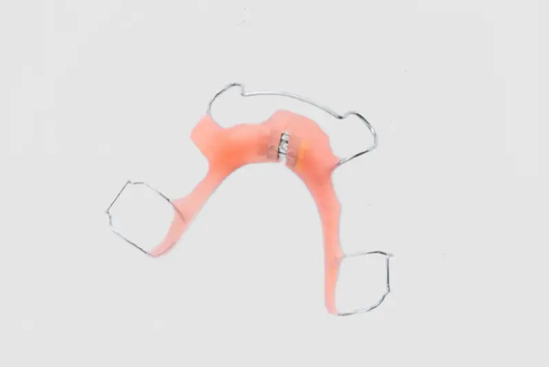 Palatal Expander (1).jpg