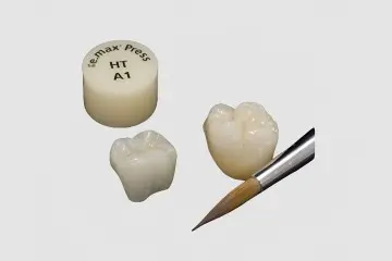 IPS e.max Lithium Disilicate All-Ceramic Crowns & Veneers