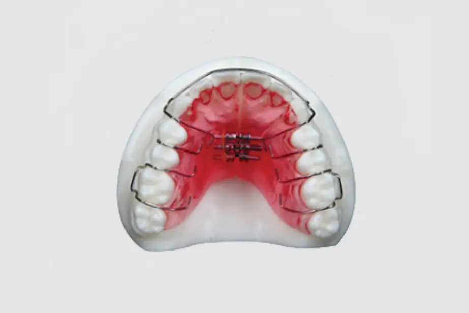 Hawley Retainers (5)