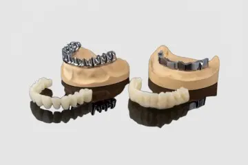 Malone Bridge Implant-Supported Fixed Prosthesis