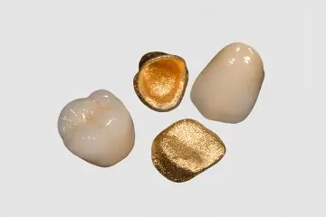 CAP-ATT Magnetic Attachment System for Overdentures