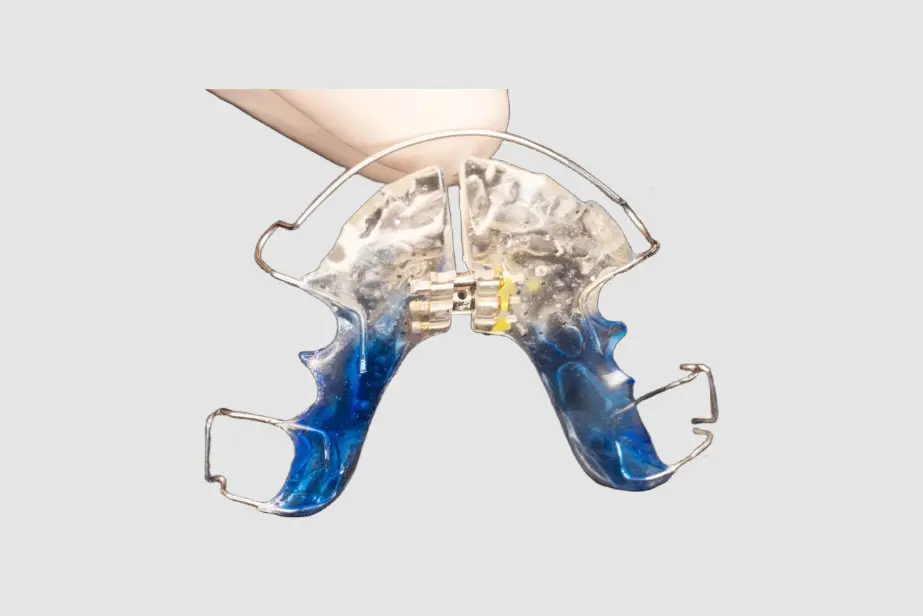 Palatal Expander (3)