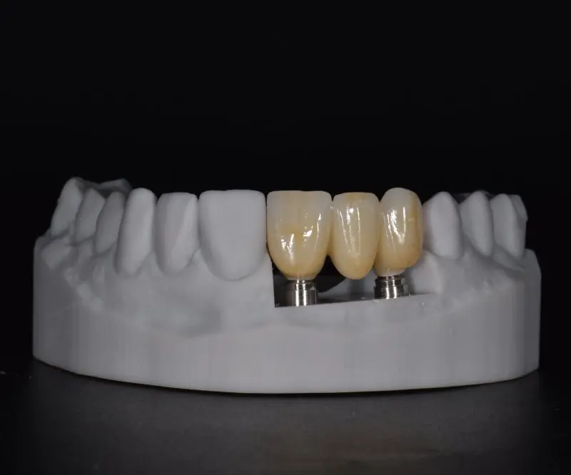 Complete Guide to B2B Dental Outsourcing: Why Global Labs and Clinics