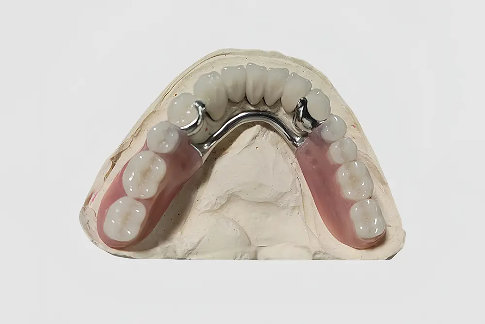 Precision Attachment (1).jpg