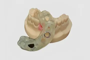 Precision Dental Implant Surgical Guide