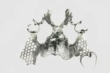 Cast Metal Framework - excellent biocompatibility and flexibility