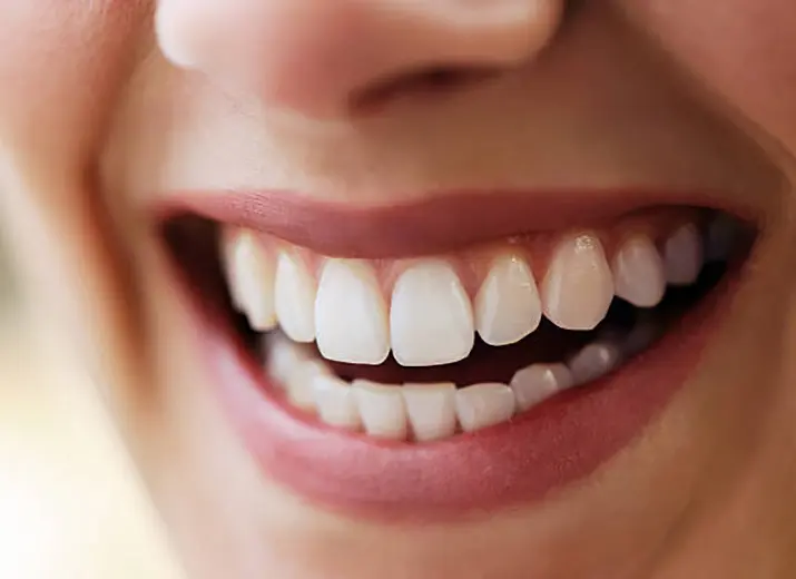 Enhancing every smile 1