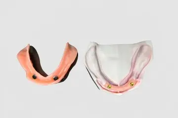 Magnetic Attachment System for Overdentures