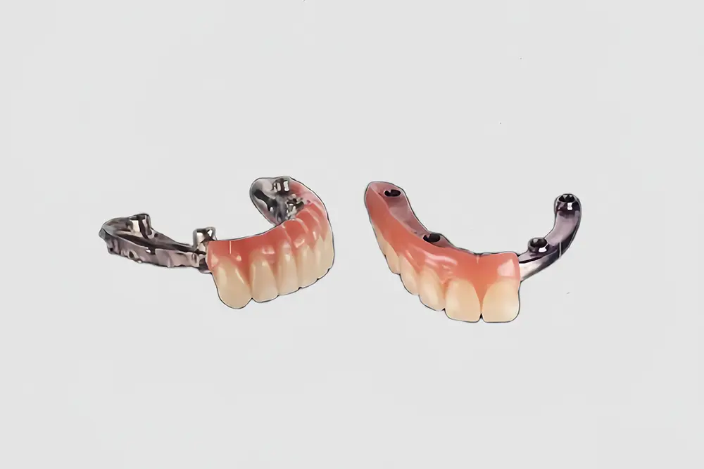 Screw-Retained Hybrid Denture (5).jpg