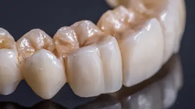 Understanding the Benefits of Removable Partials for Enhanced Oral Health