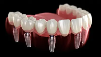 How to Choose the Right 3D Dental Implants for Optimal Patient Satisfaction and Longevity
