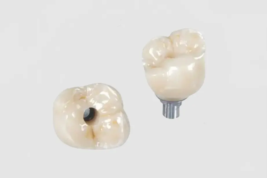 Implant Crown&Bridge (1).jpg