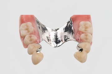 Precision Attachment - advanced dental solution