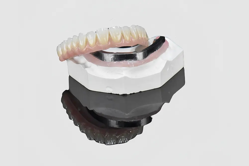 Bar-Cage Implant-Covered Denture (1)