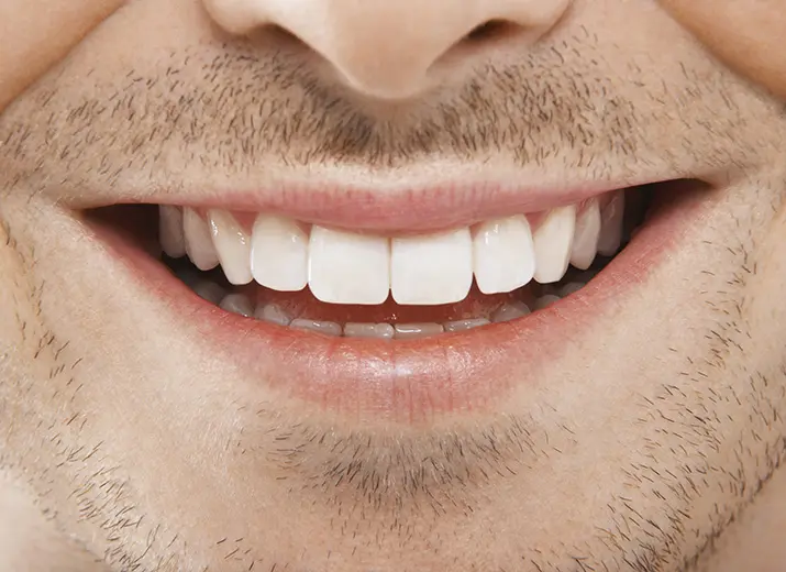 Enhancing every smile 4