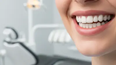 Top 10 Benefits of Zirconia Bridge for Dental Restoration in 2025